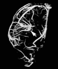 もう迷わない血管腫・血管奇形【裁断済】 m3電子書籍 | もう迷わない 血管腫・血管奇形～分類・診断と治療・手技